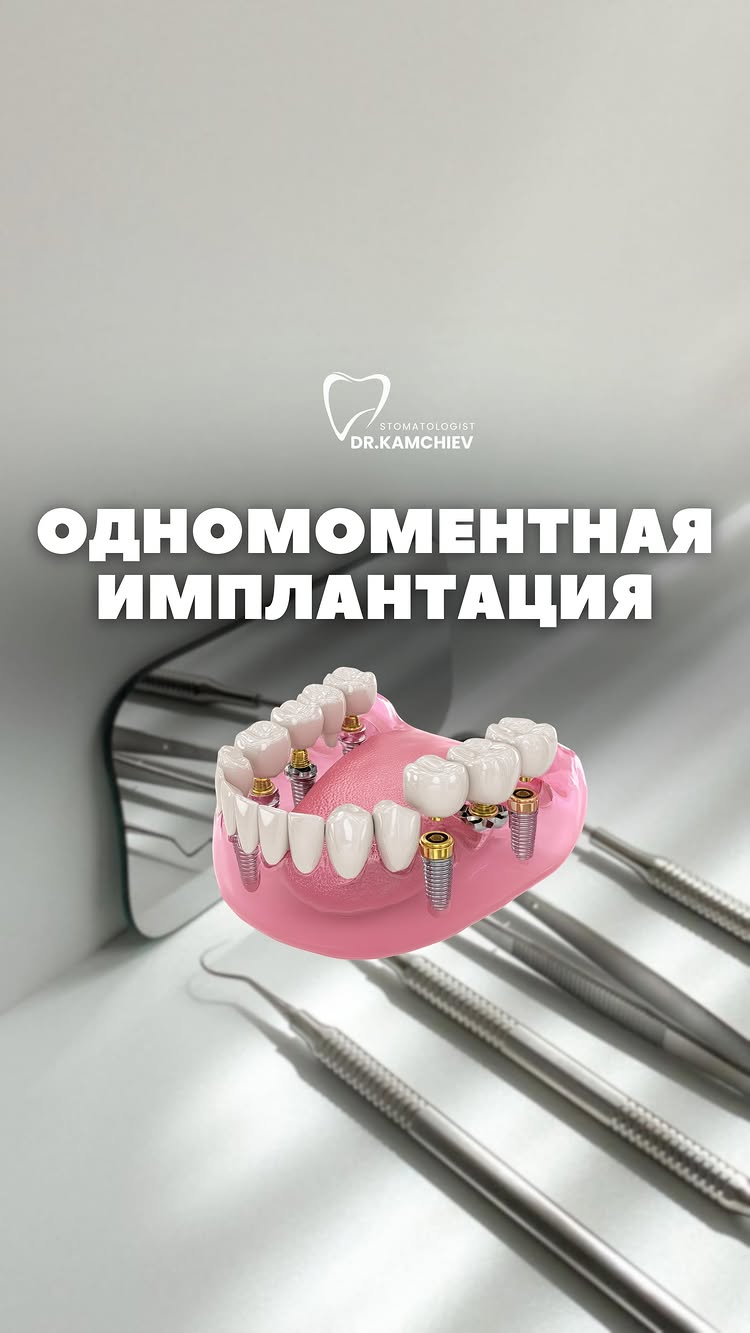Одномоментная имплантация